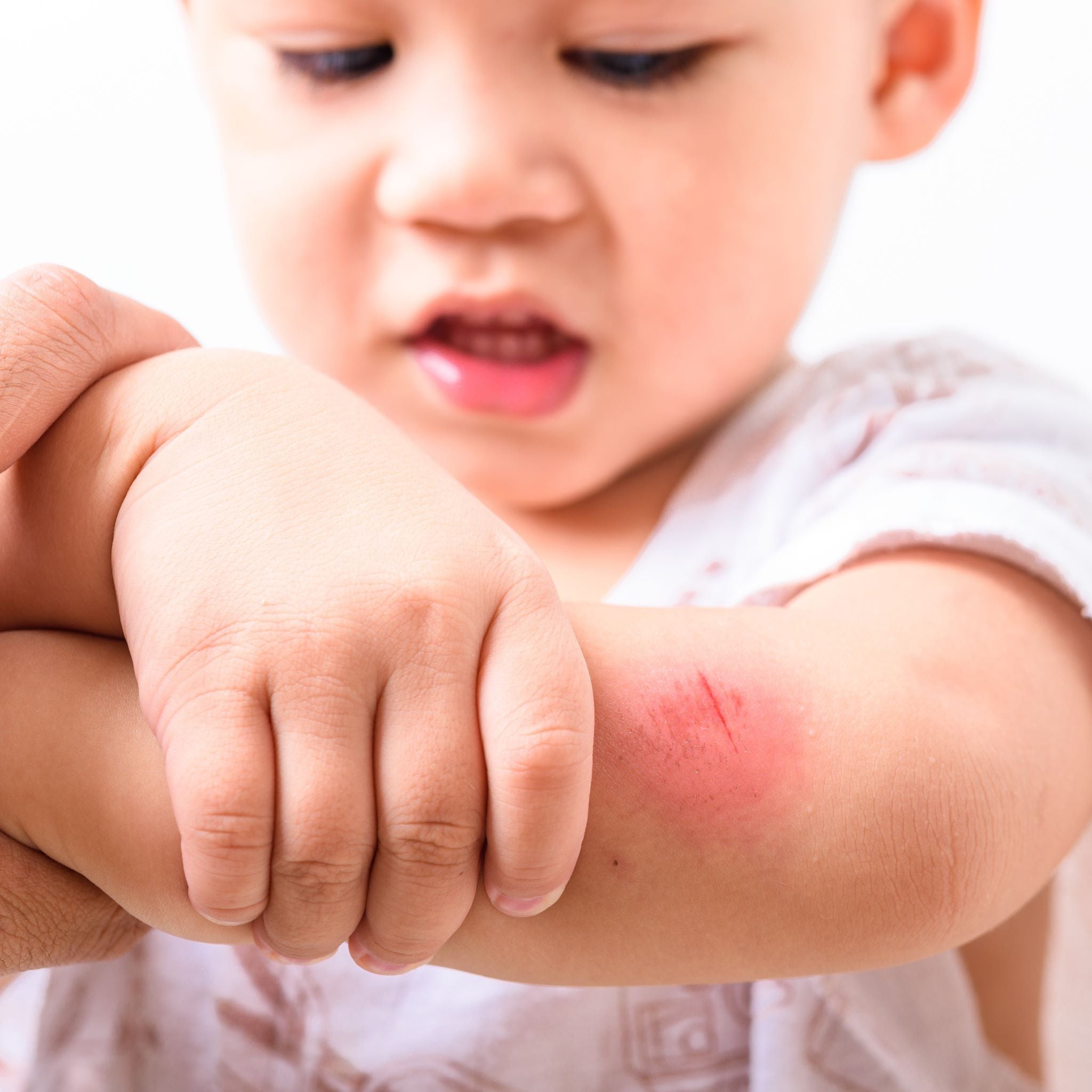 Skin Issues Resolved with Colloidal Silver