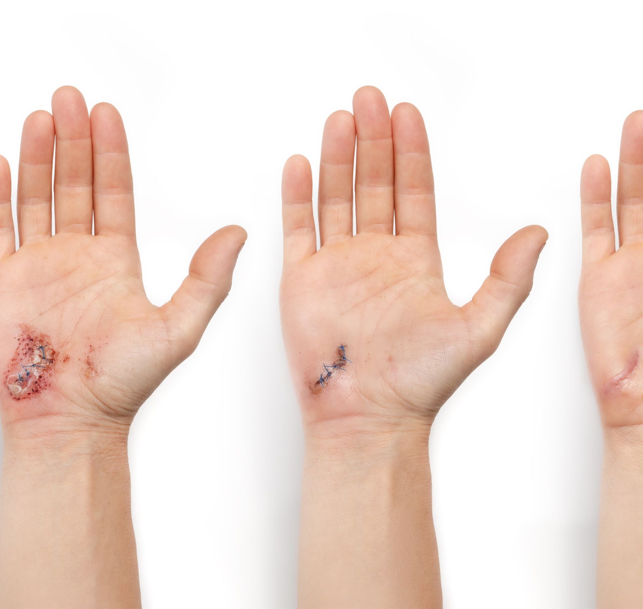 Healing the Body - Colloidal Silver